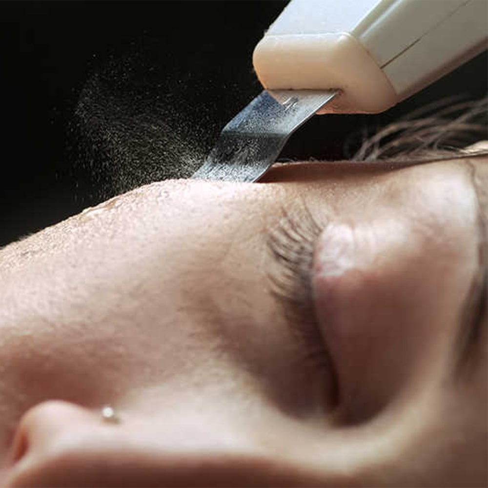 Ultraschall Peeling Gerät für bessere Haut